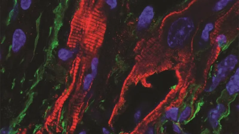 Microscopic image off fibroblasts in heart scar tissue 