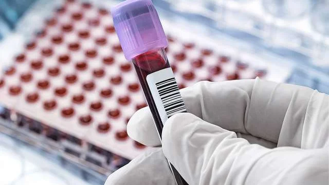 Lab worker bolding blood sample