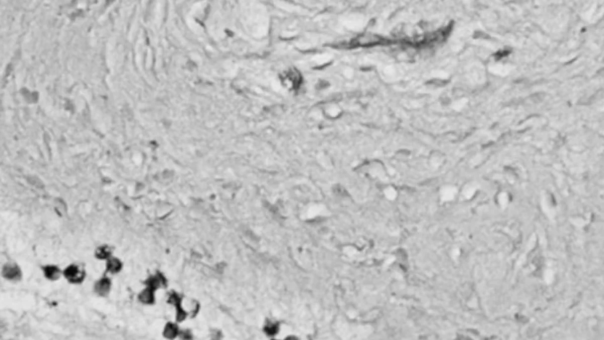Black and white histological image showing tissue structure with scattered dark-stained cells.