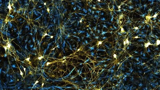 Fluorescent microscopy image of glowing neural networks on a dark background.