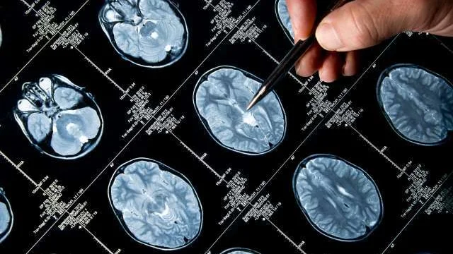 Physician pointing at brain images with pen