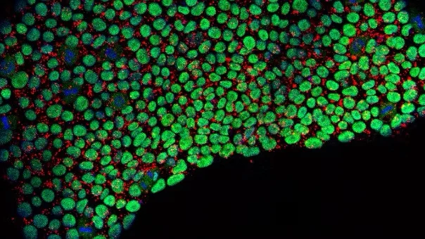 Microscopic image of stem cells