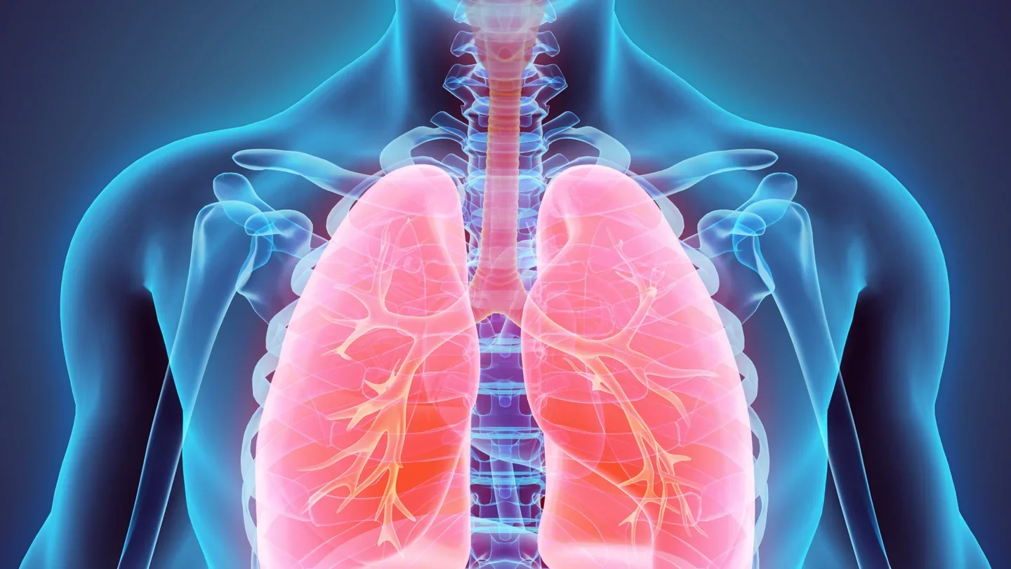X-ray image of lungs