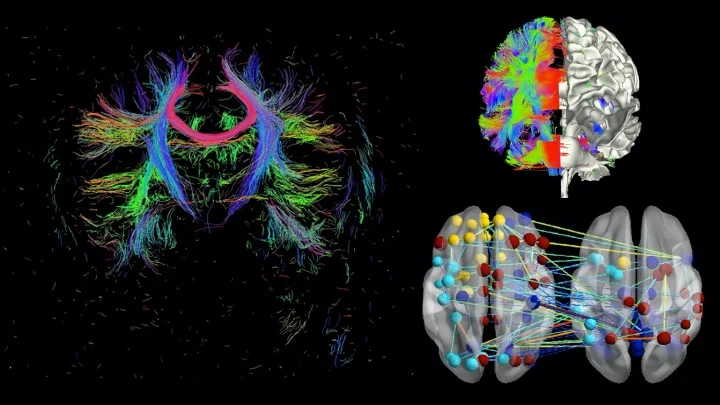 Colorful brain imaging visualizations showing neural pathways and connectivity maps.