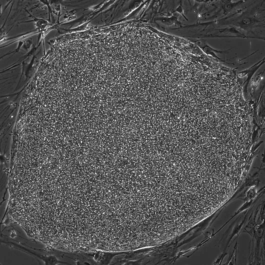 Microscopic image of Fibroblasts & PBMCs