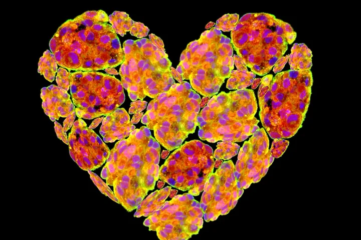 Microscopic image of Cardiac Fibroblasts