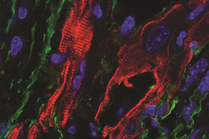 Microscopic image off fibroblasts in heart scar tissue 