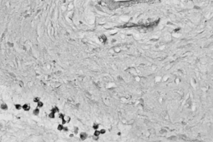 Black and white histological image showing tissue structure with scattered dark-stained cells.