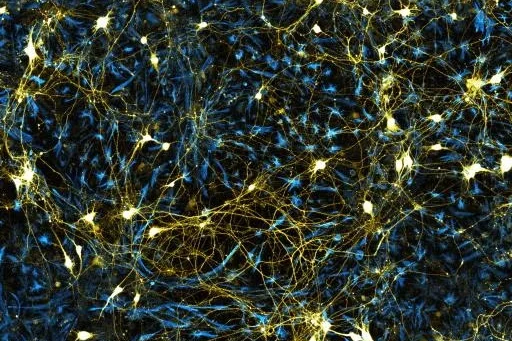 Fluorescent microscopy image of glowing neural networks on a dark background.