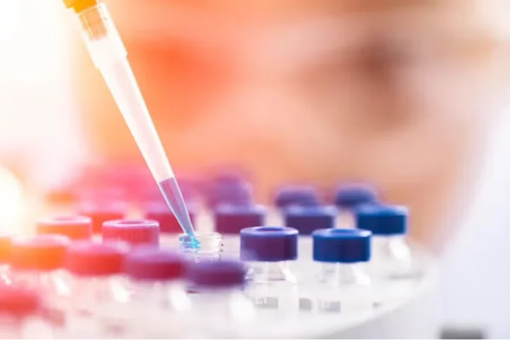 Scientist using a pipette to place liquid into vials with blue caps in a lab.