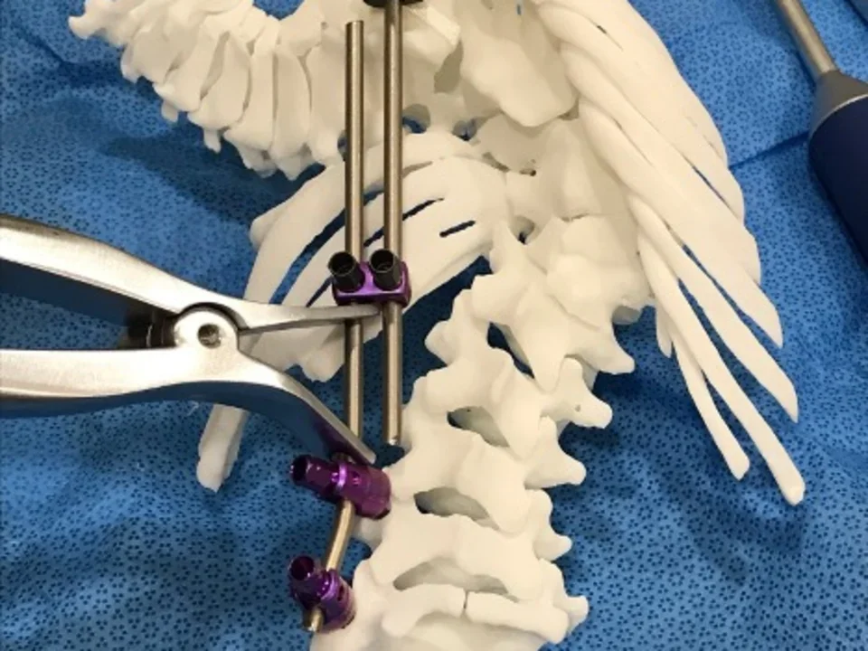 3D printing of bones