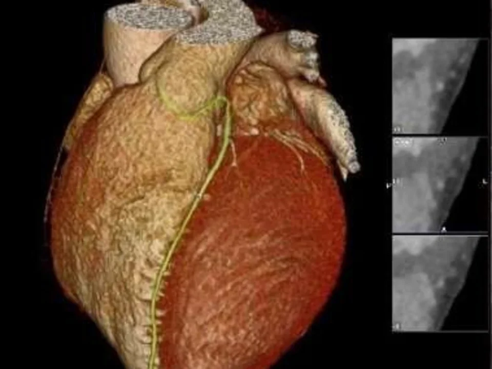 CTA 3D rendering of heart